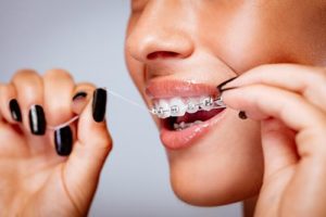 Oral Hygiene - Hook Orthodontics